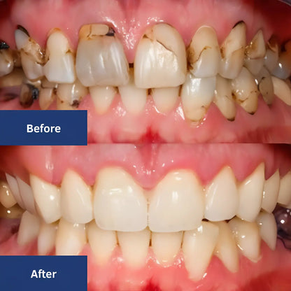 Amelaine™ Enamel Repair & Tooth Sensitivity Serum